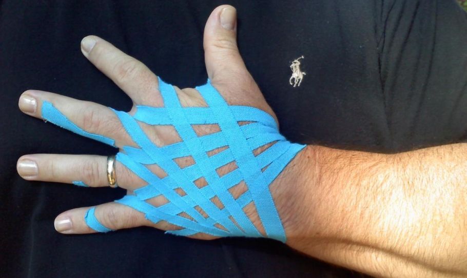 Hegkezelés másképp –Kineziotape Hegkezelés másképp –Kineziotape