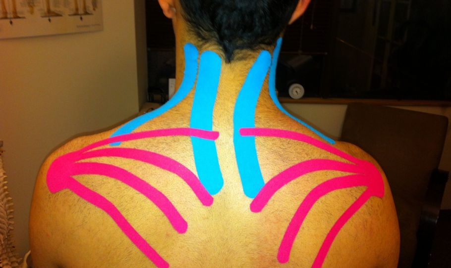 Kineziotape – fájdalomcsillapítás természetesen Kineziotape – fájdalomcsillapítás természetesen