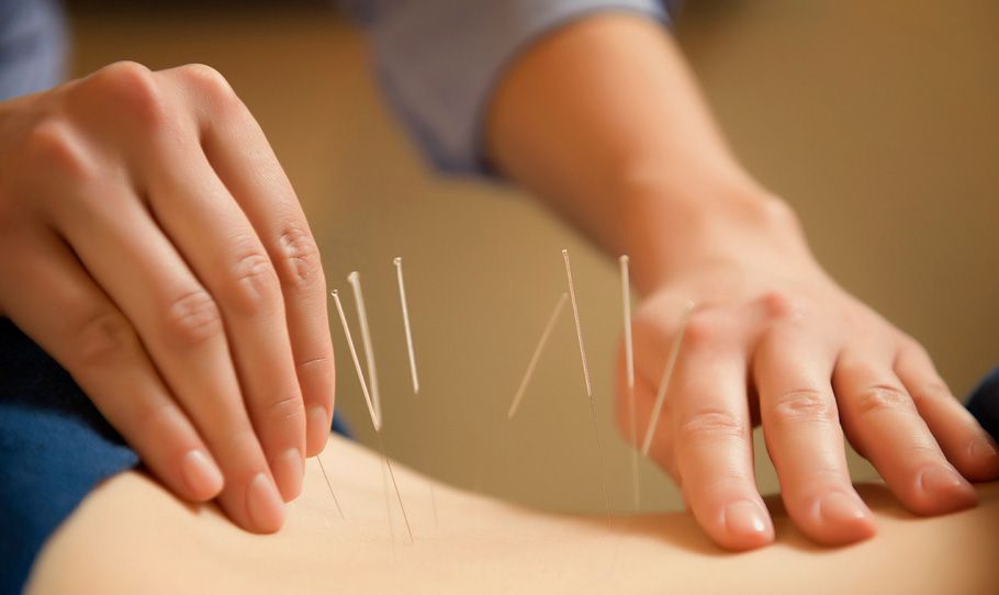Misztikus akupunktúra I.– Egy ősi módszer a modern orvoslásban