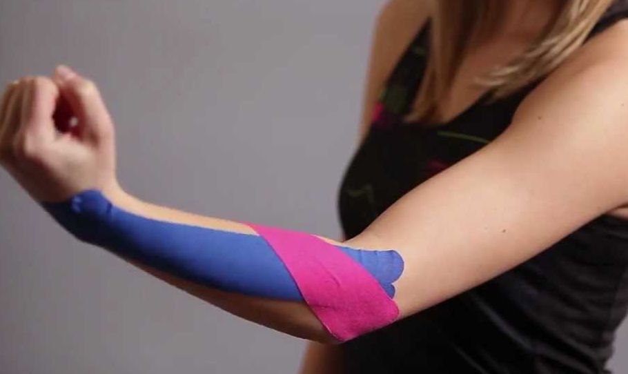 könyök kinesio tape fájdalomtörés a könyökízületben