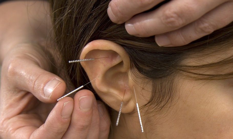 Tested a füledben – A fülakupunktúráról Tested a füledben – A fülakupunktúráról